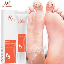 Anti Fungal Foot Cream Treatment